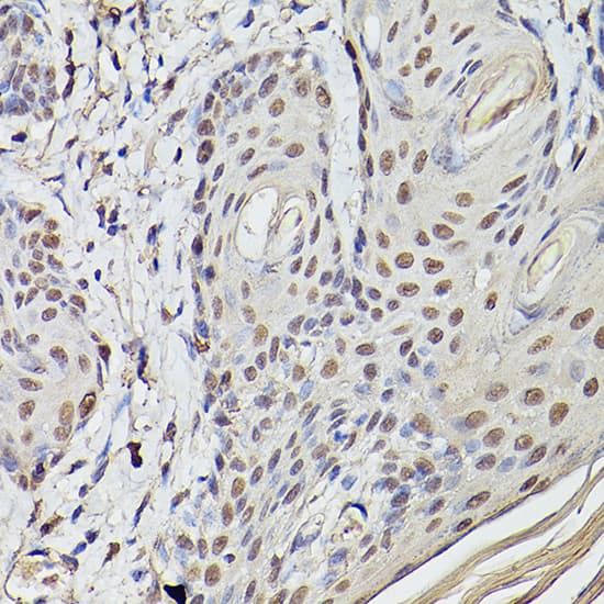 Pea3 Antibody