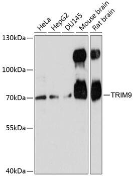 TRIM9 Antibody