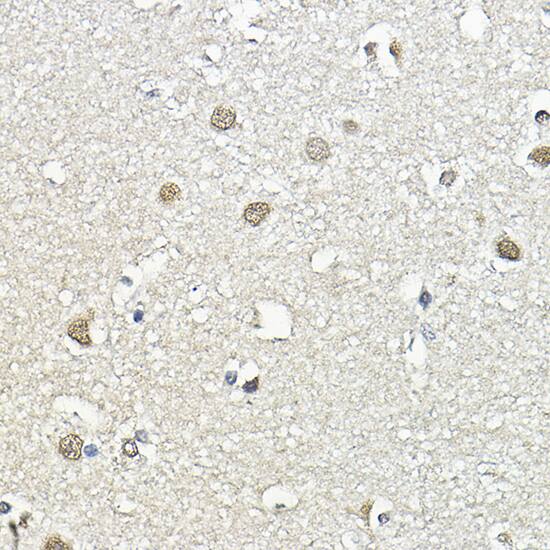 NCBP1 Antibody