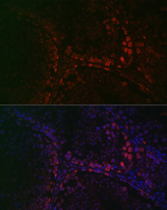 DAZL Antibody