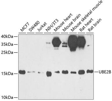 HR6B/UBE2B Antibody