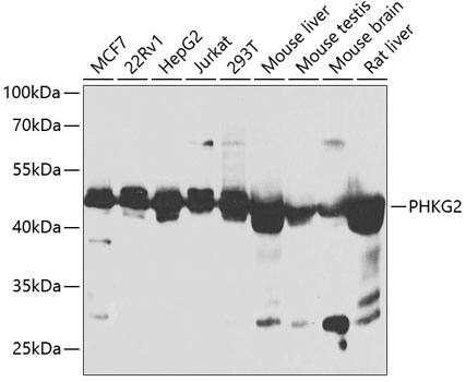 PHKG2 Antibody