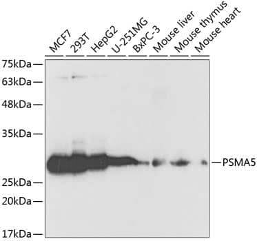 Proteasome 20S alpha 5 Antibody