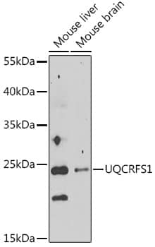 UQCRFS1 Antibody