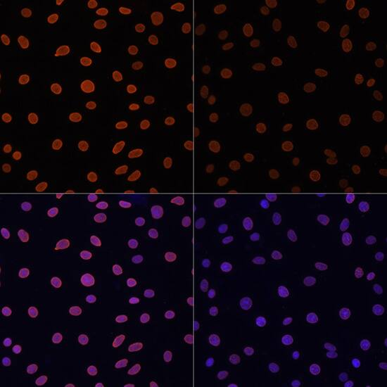 H4 Clustered Histone 1 [ac Lys12] Antibody