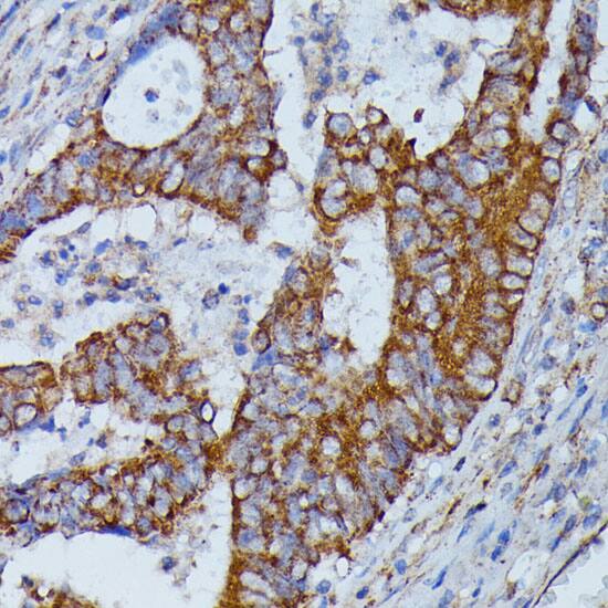 HMGCS2 Antibody