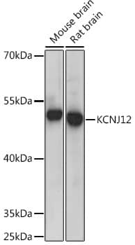 Kir2.2 Antibody