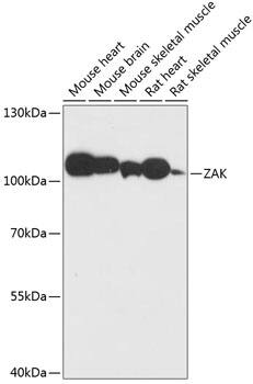 ZAK Antibody