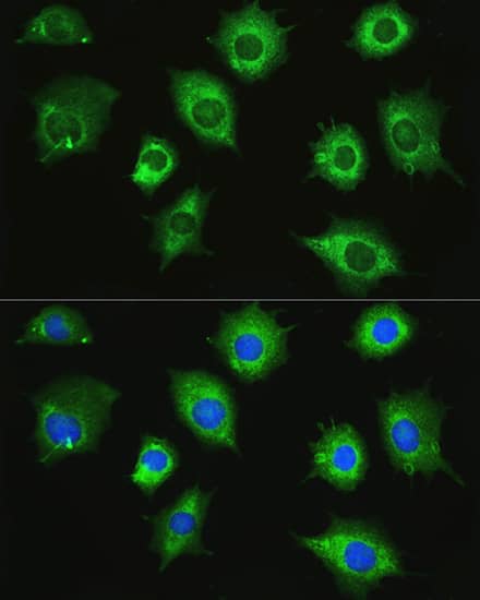 ZAK Antibody