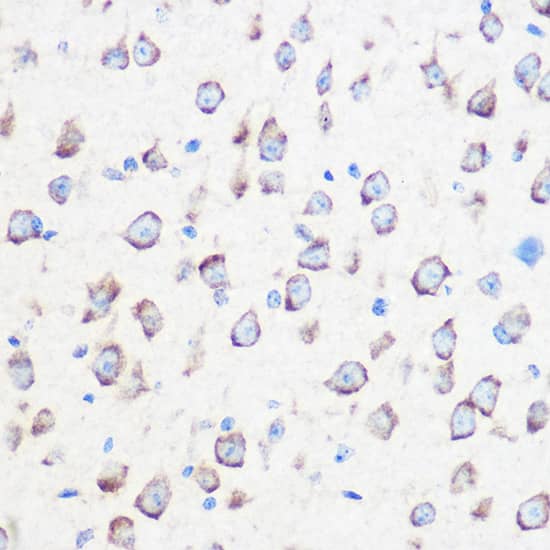 Calmodulin 3 Antibody