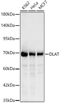 Pyruvate Dehydrogenase E2 Antibody