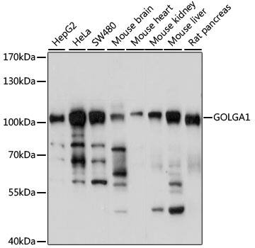 Golgin 97 Antibody