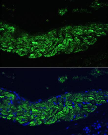 12-Lipoxygenase Antibody