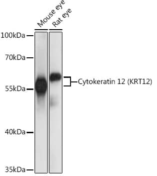 Cytokeratin 12 Antibody