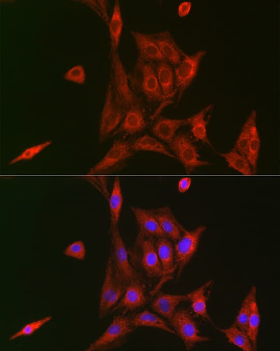 NFkB p105/p50 Antibody