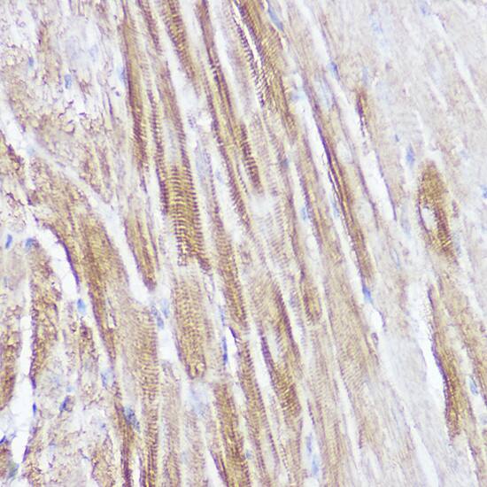 Atrial Natriuretic Peptide/ANP Antibody