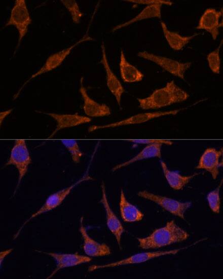 RPE Antibody