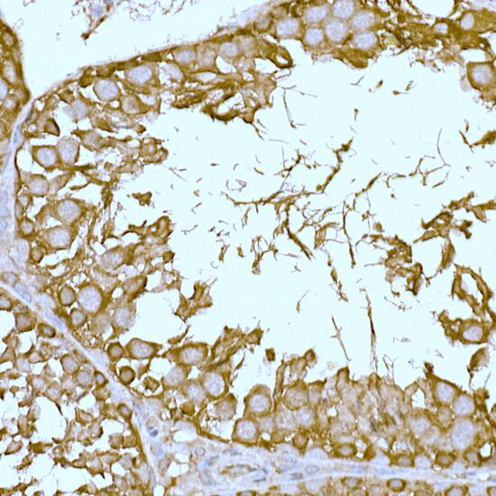 CAT1 Antibody