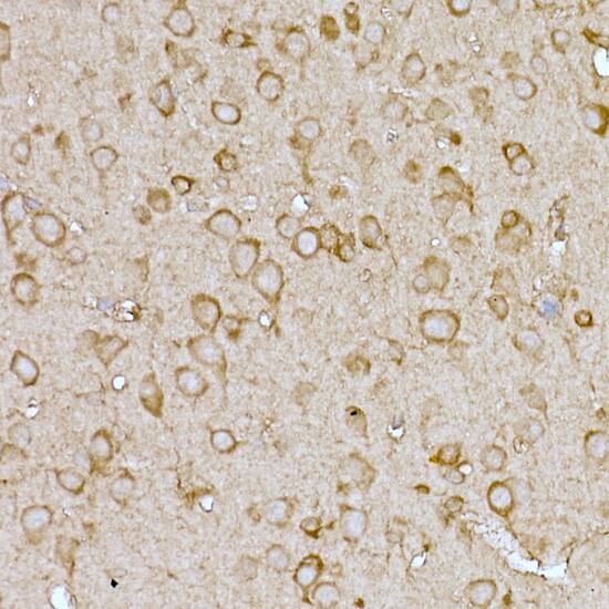 CAT1 Antibody