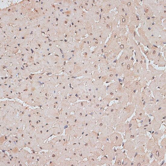 TLK1 Antibody