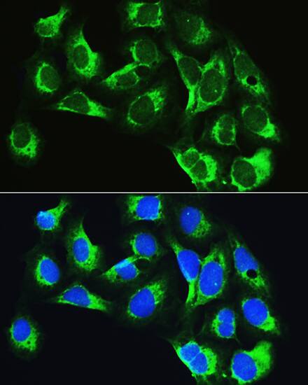 LARS Antibody