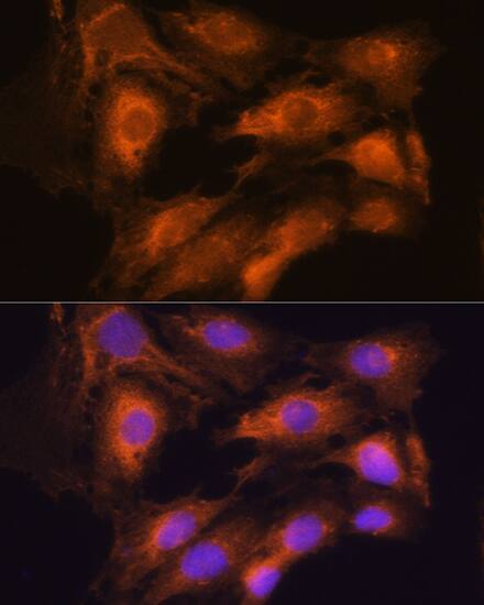 Coatomer Subunit Delta Antibody