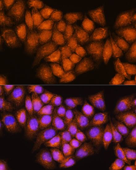 Coatomer Subunit Delta Antibody