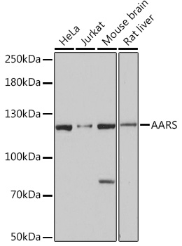 Alanyl tRNA synthetase Antibody