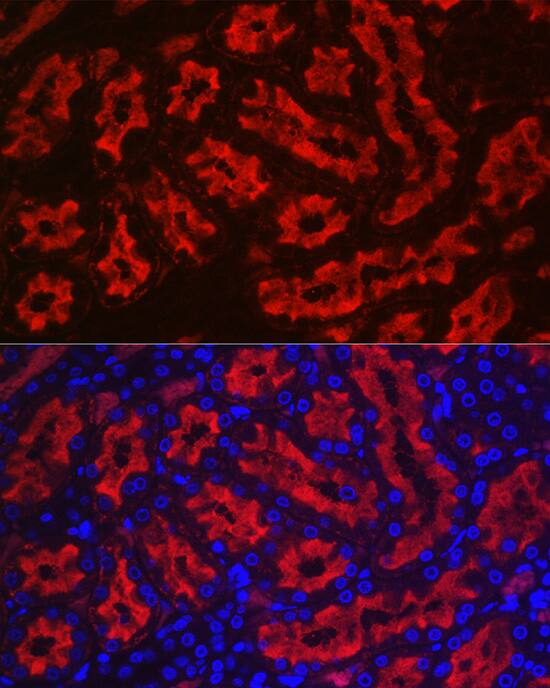Aquaporin 1/AQP1 Antibody