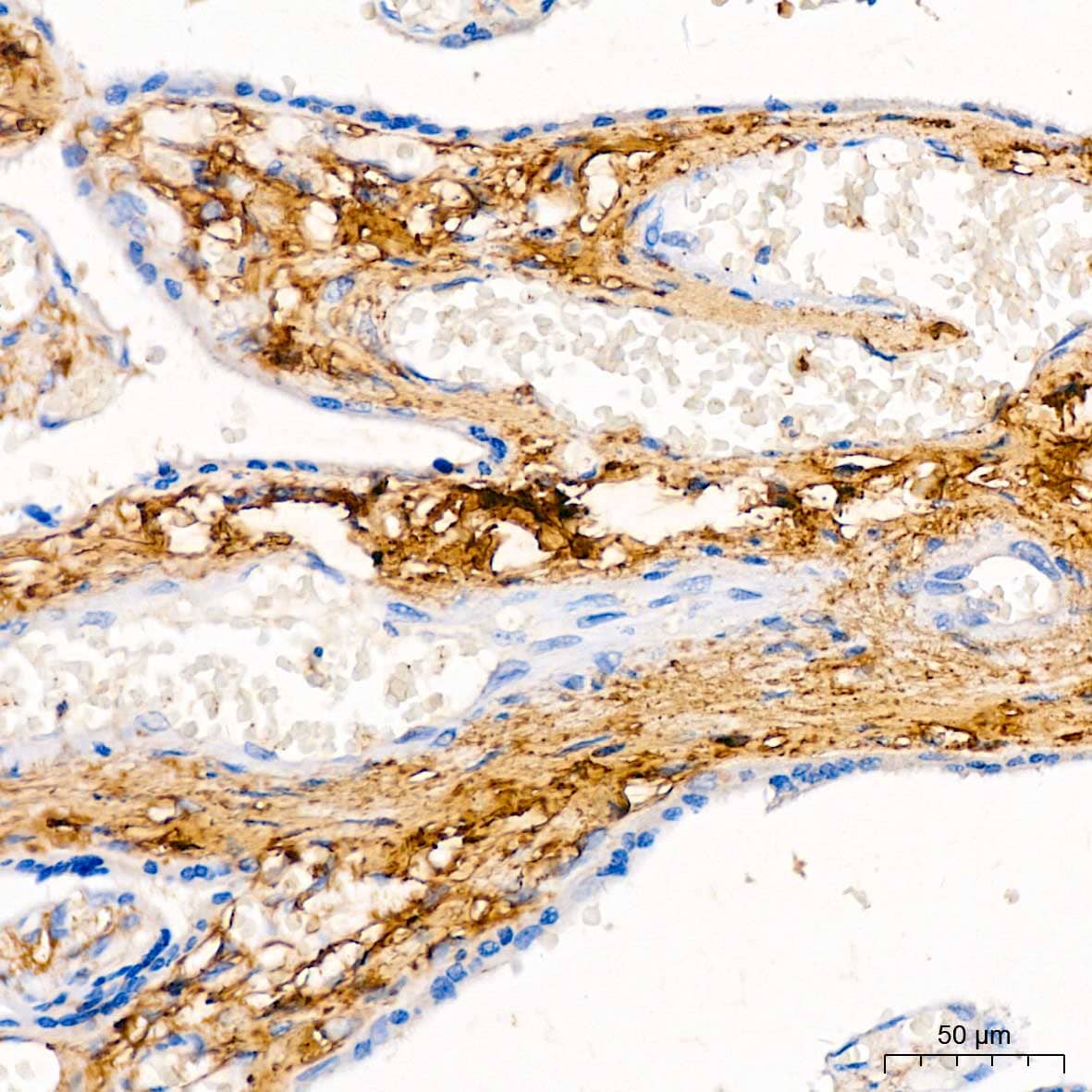 Decorin Neo Antibody