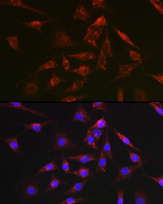 Decorin Neo Antibody