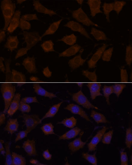 OXSR1 Antibody