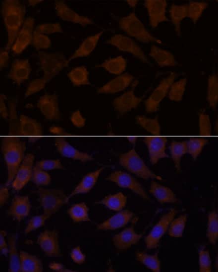 OXSR1 Antibody