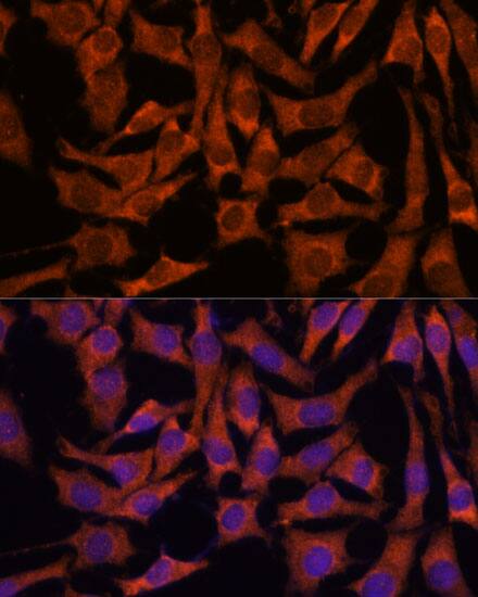 SEC23B Antibody