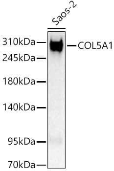 Collagen V Antibody