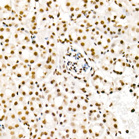 H4 Clustered Histone 1 [ac Lys5] Antibody