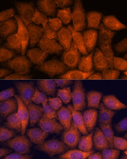 FLJ21908 Antibody