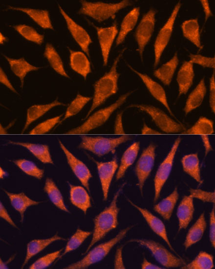 FLJ21908 Antibody