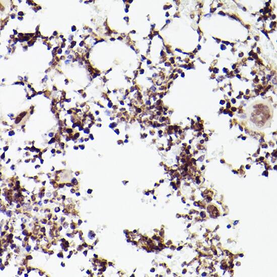 TET2 Antibody