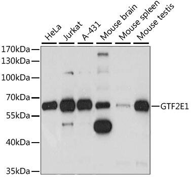 TFIIE-alpha Antibody