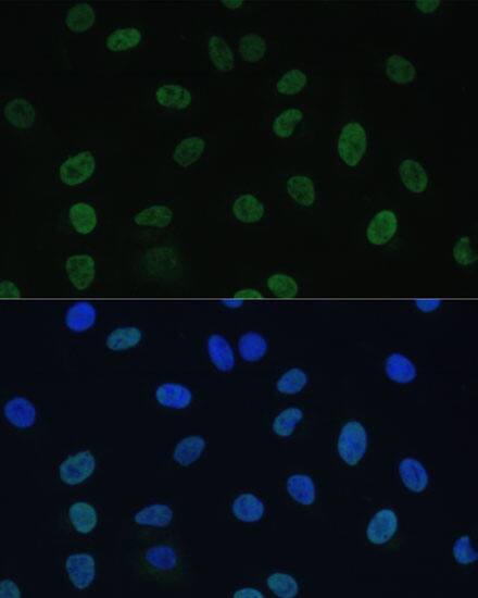 TFIIE-alpha Antibody