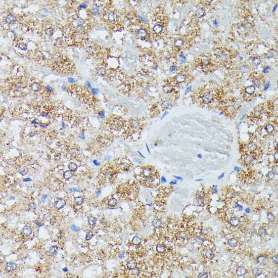 IVD Antibody