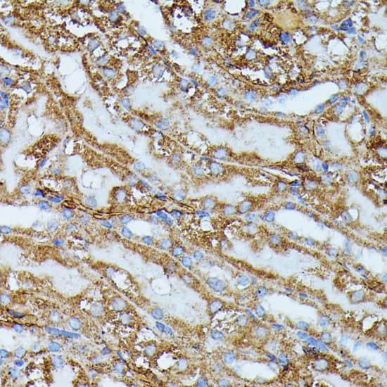 IVD Antibody