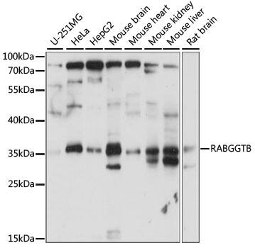 RABGGTB Antibody