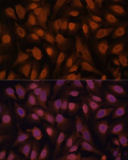 ZNF131 Antibody