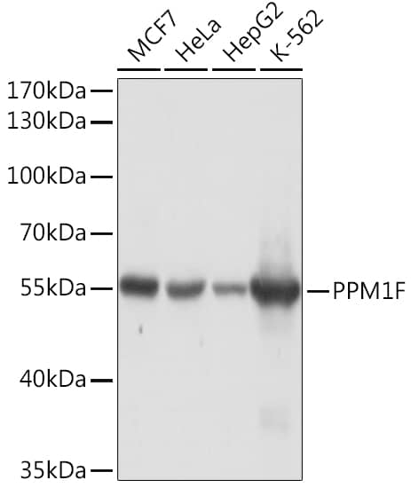 Protein phosphatase 1F Antibody