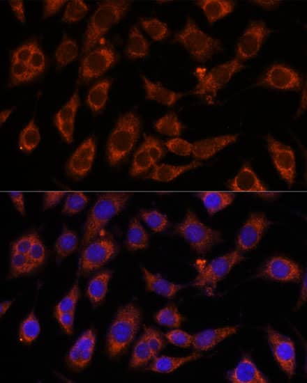 GFPT2 Antibody