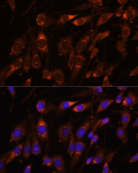 FARSB Antibody