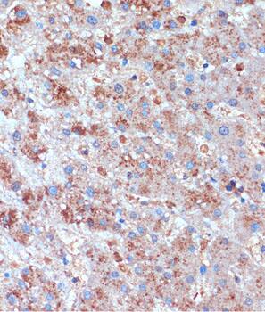 TCIRG1 Antibody