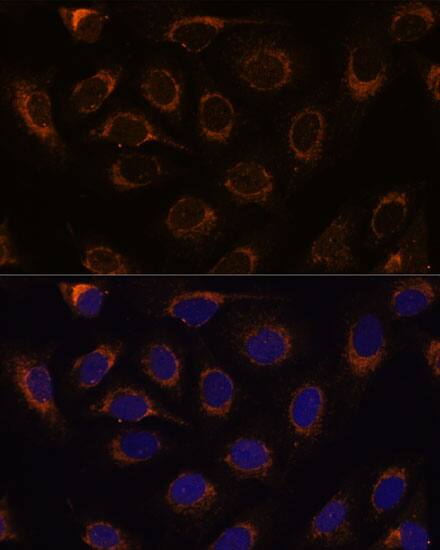 TCIRG1 Antibody